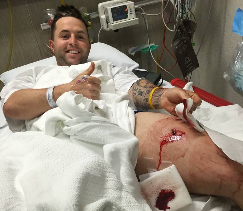 THUMBS UP: Belvoir cricket recruit Dylan Wright clearly didn't win his fight with a cricket stump. But the keeper-batsman can see the funny side of the freak training mishap, which saw the stump spear into his thigh.