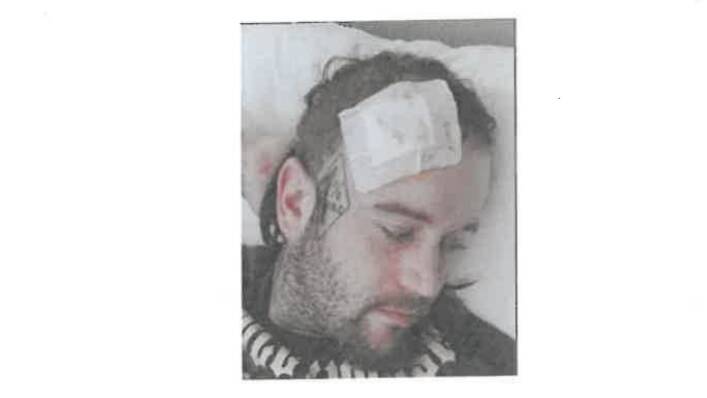 A police image of Melbourne with an injury to his head. Picture by Victoria Police 